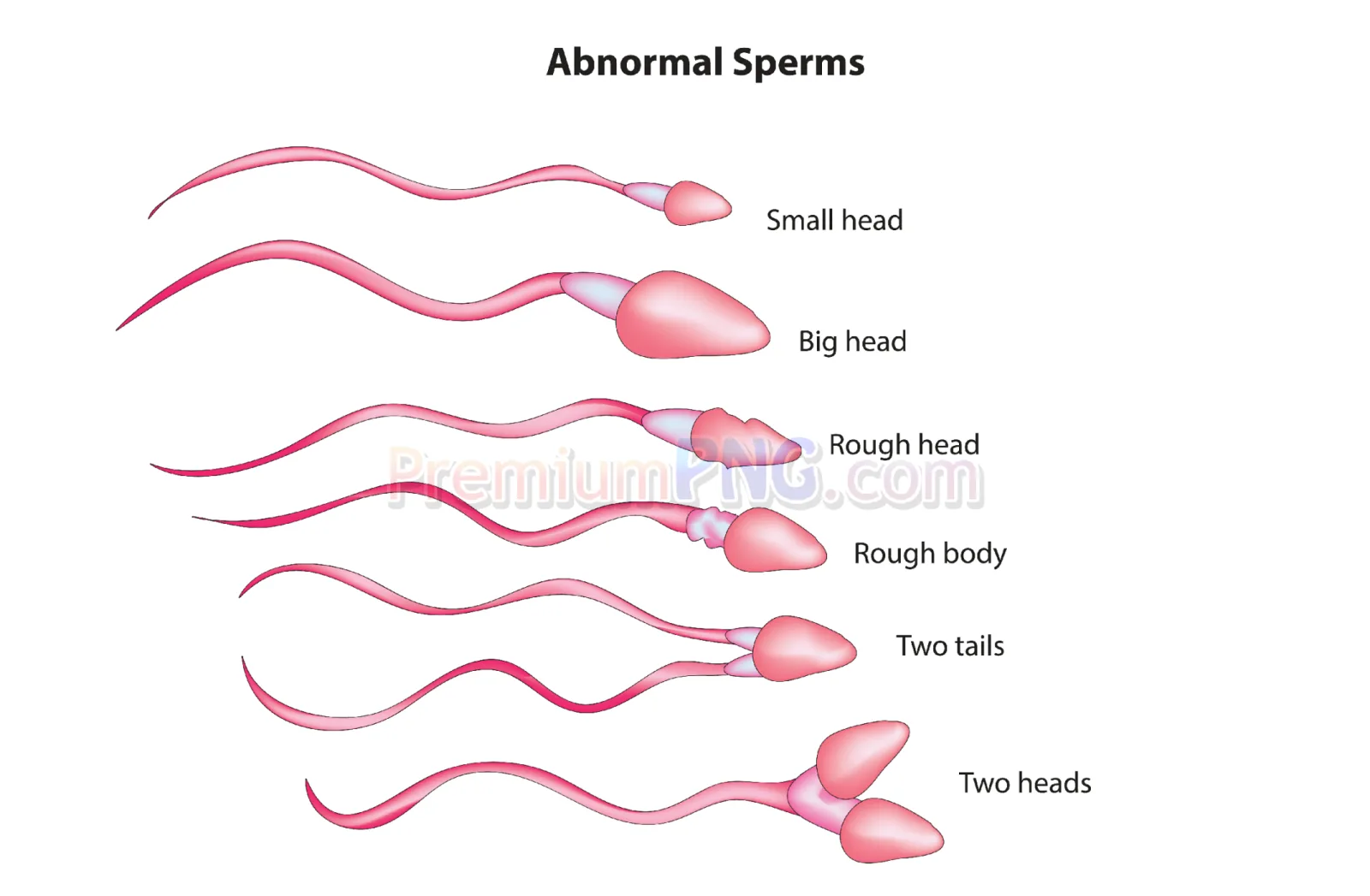 Abnormal Sperm Cell Biology Vector EPS | High-Quality Medical Clipart | PremiumPNG