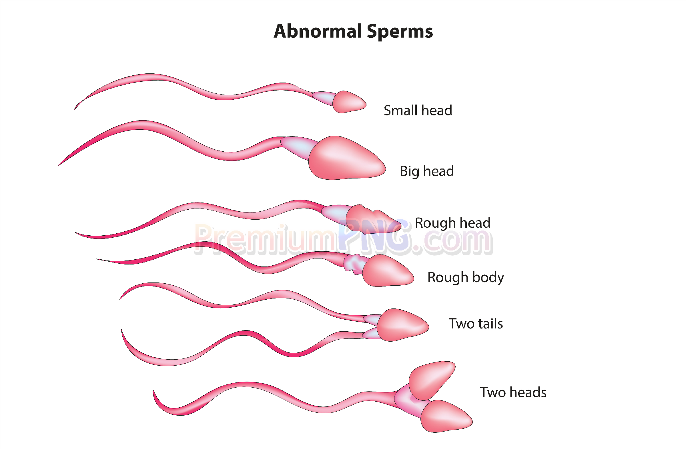 Abnormal Sperm Cell Biology Vector EPS | High-Quality Medical Clipart | PremiumPNG